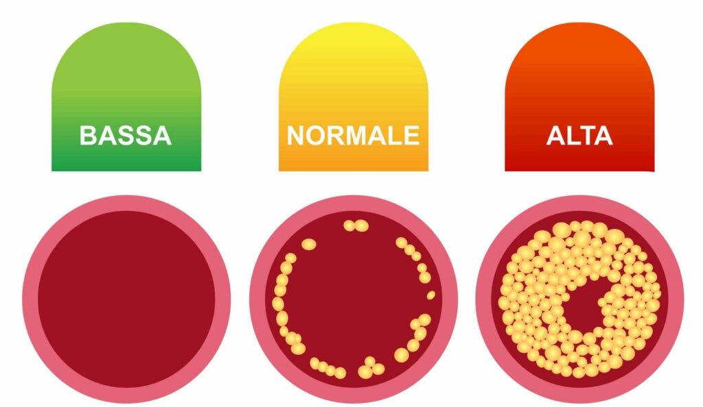 colesterolo-alto-come-si-possono-regolare-i-livelli