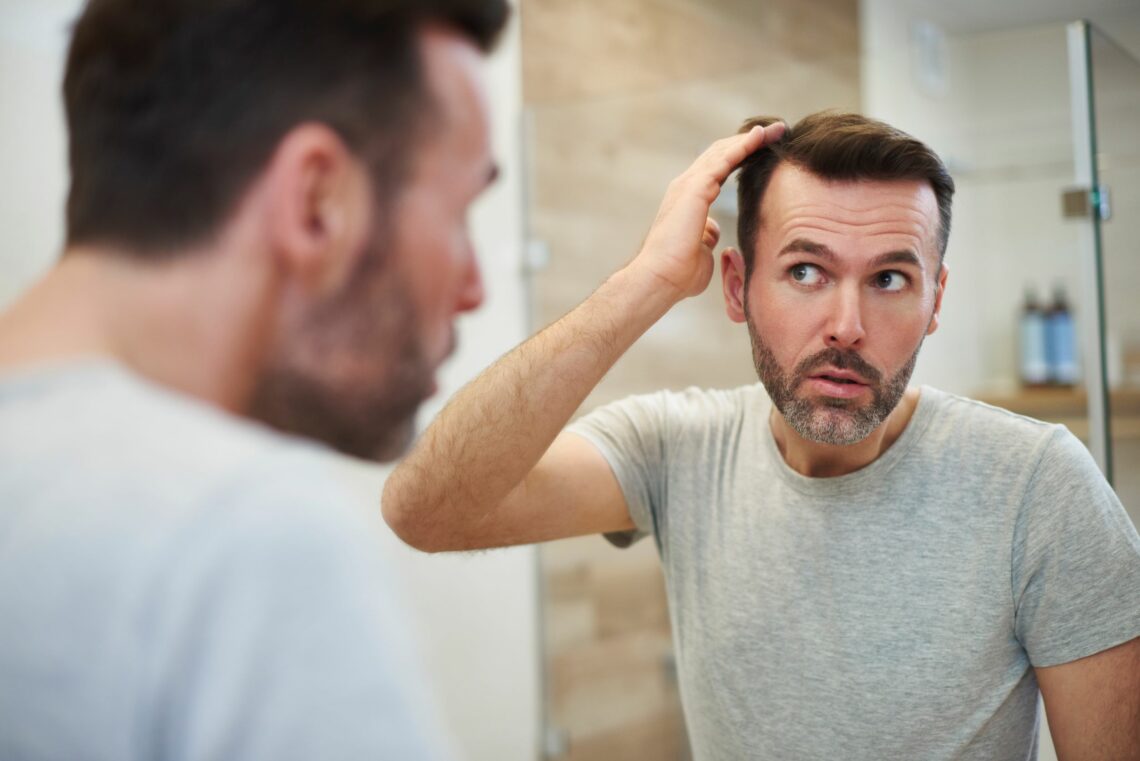 trapianto-di-capelli-in-italia-dove-farlo