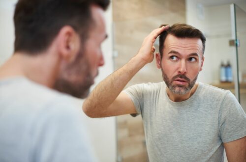 trapianto-di-capelli-in-italia-dove-farlo