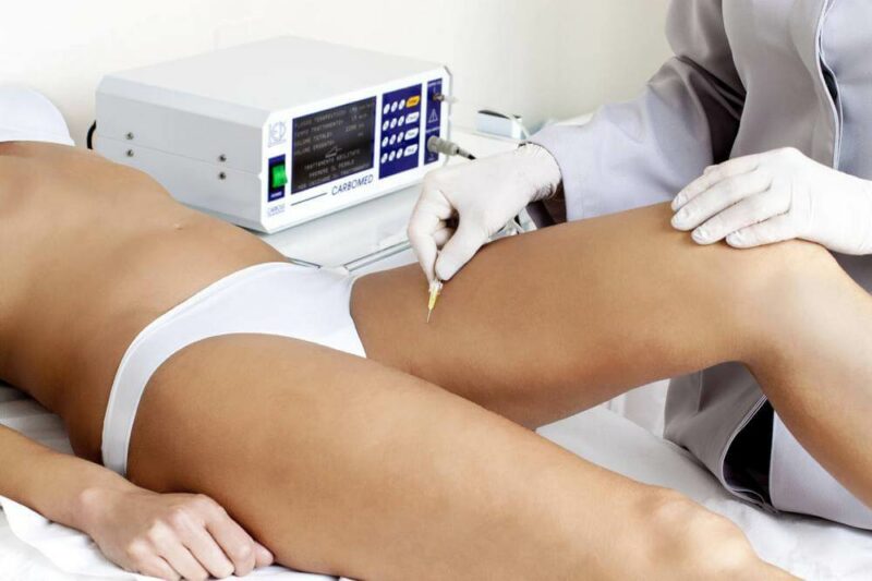 nuovi-trattamenti-per-eliminare-e-ridurre-la-cellulite